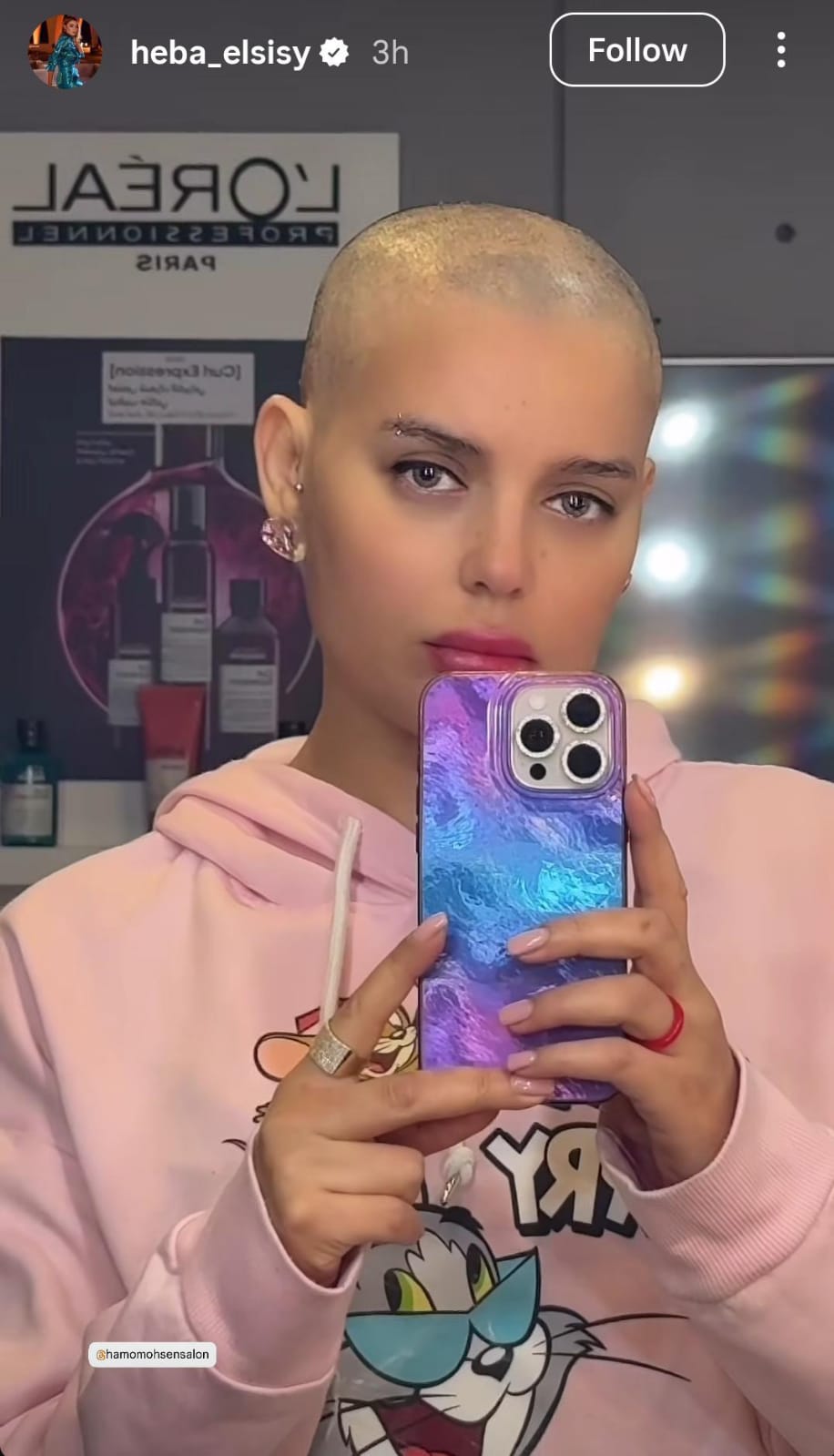 هبة السيسي تتحدث عن سبب رفضها الظهور بشعر مستعار وعلاقتها بـ 