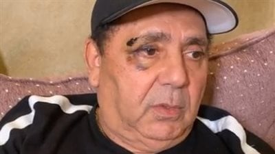 إصابة علا غانم بنزيف وارتجاج في المخ وكسور في العظام وأول صورة لها بالمستشفى