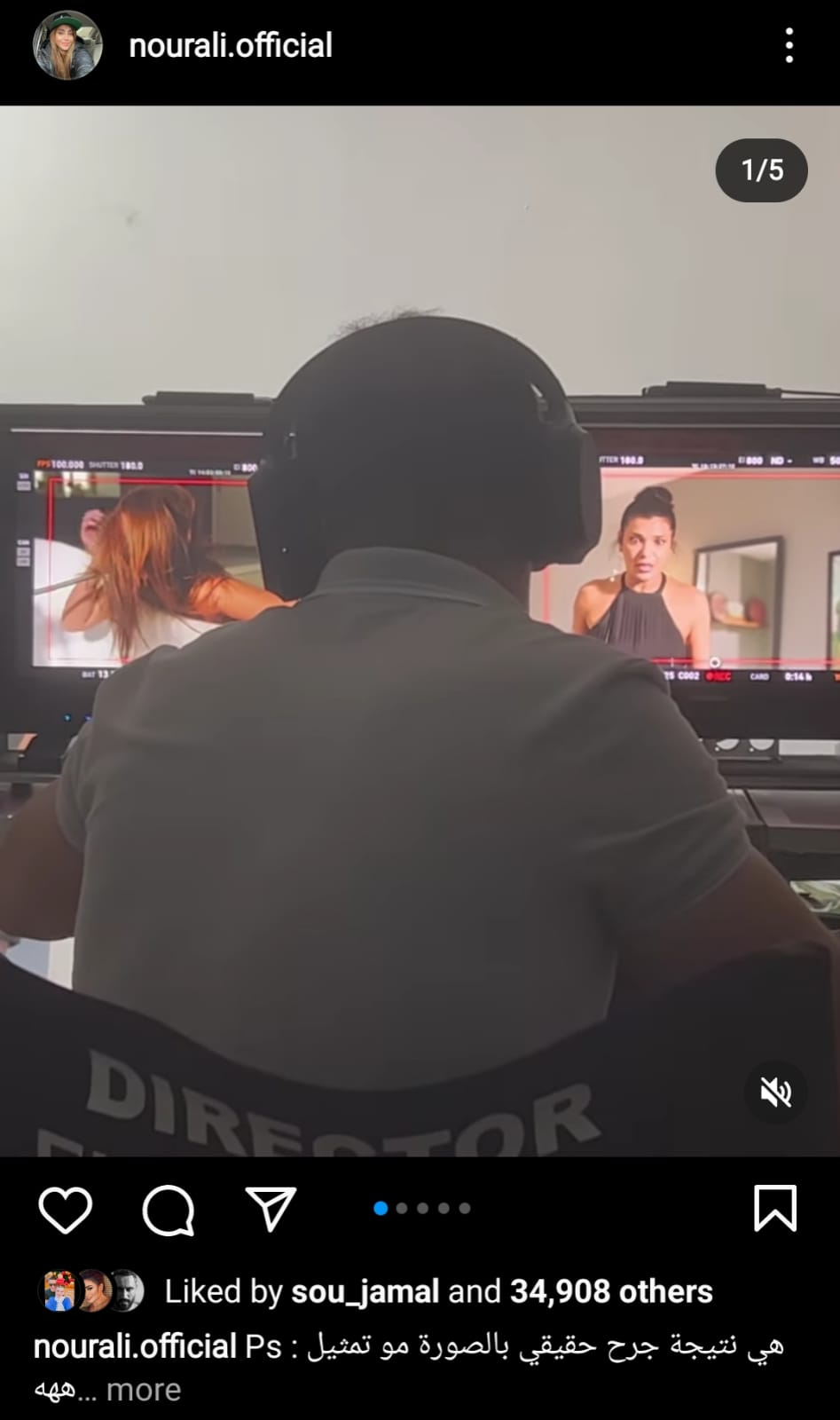 إصابة نور علي في ستليتو أثناء مشهد ضرب ندى أبو فرحات