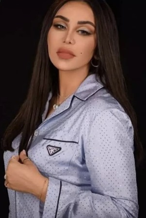 أحلام تتصدر الترند وتكشف سر النظارة السوداء