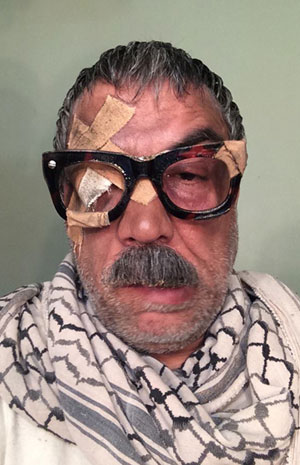 إصابة أيمن رضا بقذيفة هاون! | نواعم