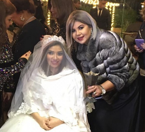 غادة رجب تكشف تفاصيل حادث كاد أن يفقدها بصرها