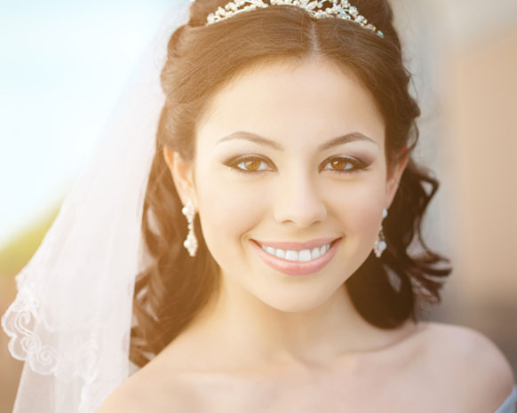 احصلي على أسنان عروس بيضاء لأجمل صور زفاف