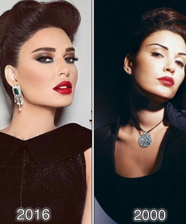 هكذا تغيّرت ملامح سيرين عبد النور بين الأمس واليوم