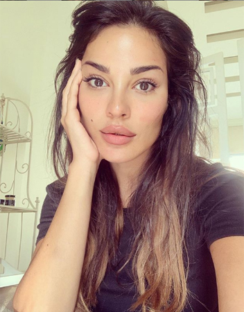 نادين نجيم بصورة صادمة من المستشفى بعد انفجار بيروت