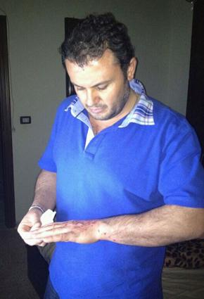 ربيع الأسمر ينجو من حادث سير مروّع