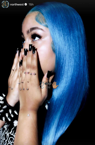 ابنة كيم كاردشيان تفاجىء المتابعين بثقوب في يدها!