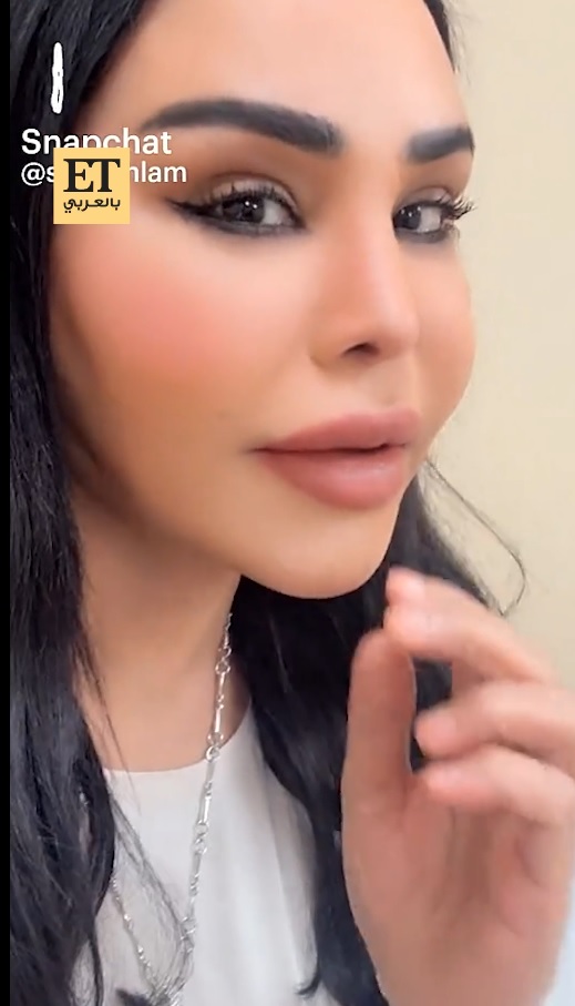 فيديو.. أحلام تكشف تفاصيل عملية تجميل أنفها